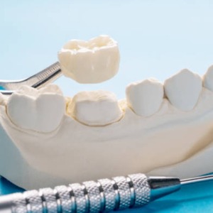 tooth crown dental care