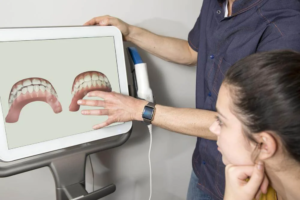 iTero Digital Scanner